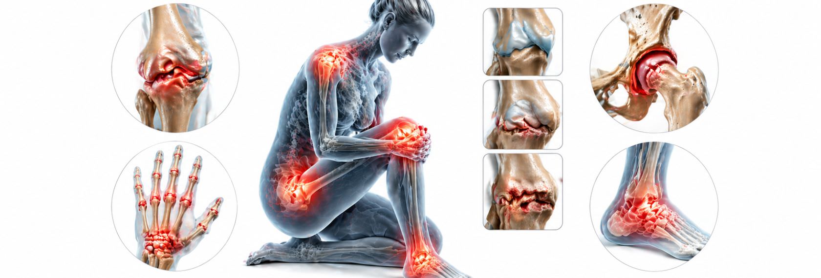 Trattamento osteopatico per l'infiammazione articolare